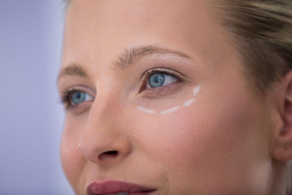 Under Eye Fillers