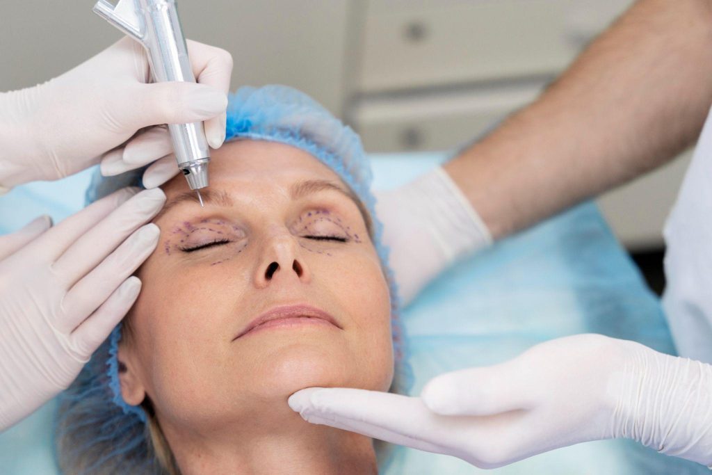 Under Eye Fillers