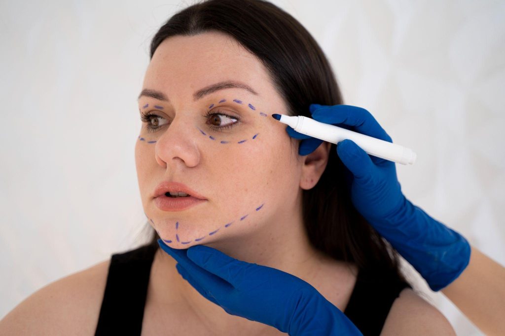 Under Eye Fillers
